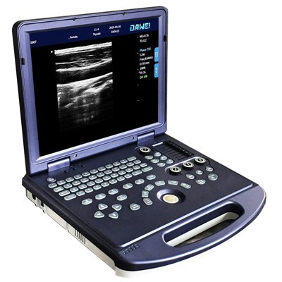 Ultrasound Iswed-u abjad li jinġarr ta' 15.6-pulzier