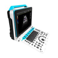 Ultrasound Doppler tal-Kulur tat-Tròli